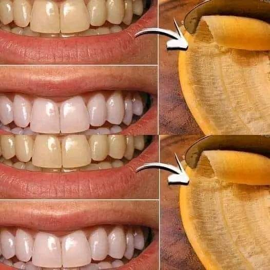 Secret that Dentists don’t want you to know